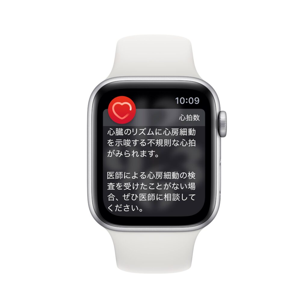 Apple Watchの心房細動通知機能について