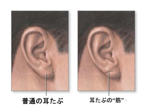 自身でチェックできる病気の兆候：耳たぶの筋で狭心症が診断できる？｜お知らせ｜中目黒診療所